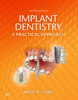 Implant Dentistry, Second Edition