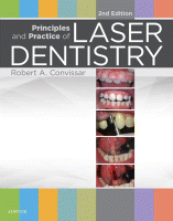 Principles and Practice of Laser Dentistry, Second Edition